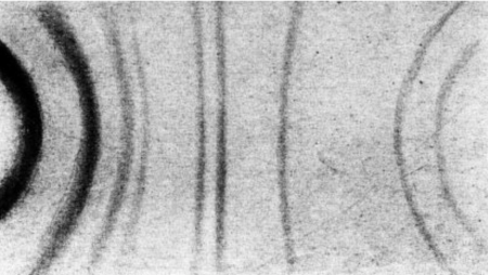 x ray